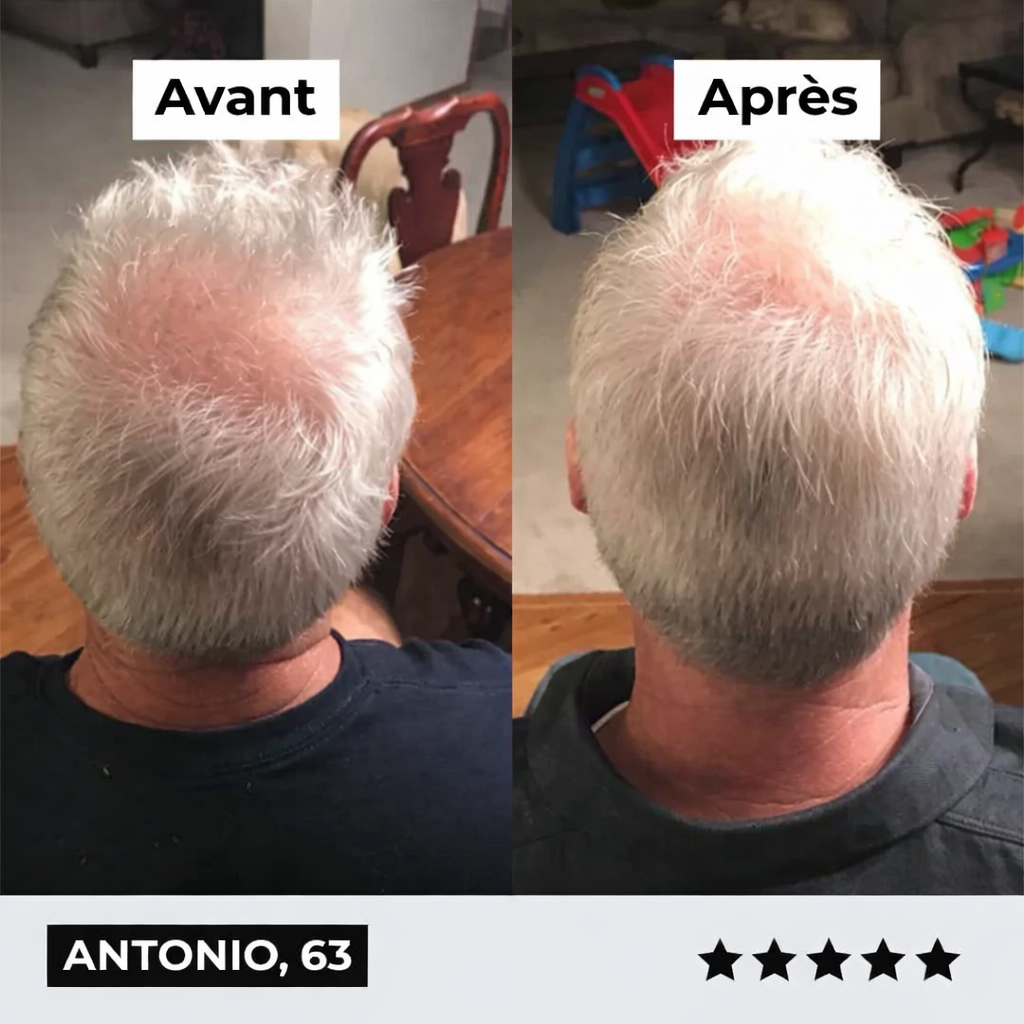 Micro-Infusion Density Pro+®