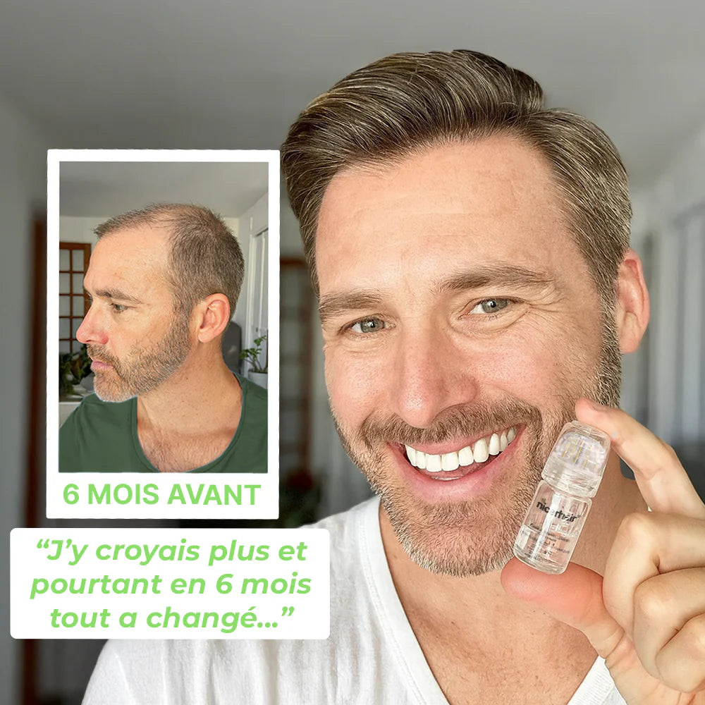 Micro-Infusion Density Pro+®